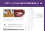 Complications en chirurgie du rachis