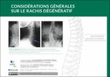 Considérations générales sur le rachis dégénératif