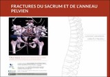 Les fractures du sacrum et de l’anneau pelvien