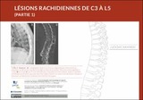 Lésions du rachis de C3 à L5 (Partie 1)