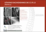 Lésions du rachis de C3 à L5 (Partie 2)